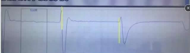 正极性闪测仪冲闪测试波形光标定位方法２